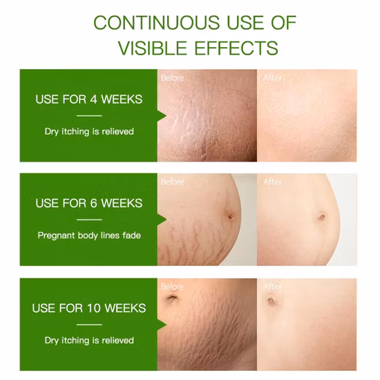 Venta al por mayor, 100% de cabello puro, masaje facial para el cuerpo, estrías, elimina el dispensador de aromaterapia, fragancia de aceite esencial de jazmín